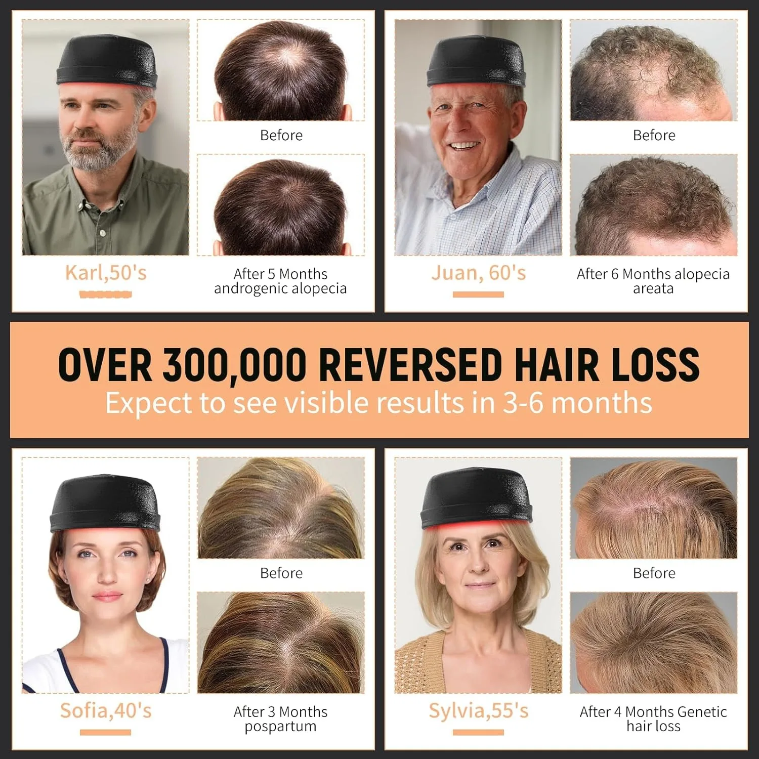 New Hair Growth Laser Cap 660nm 850nm Red Light Therapy Helmet 120LEDs Hair Growth Device for Seborrheic Alopecia Hair Loss ﻿ view 6