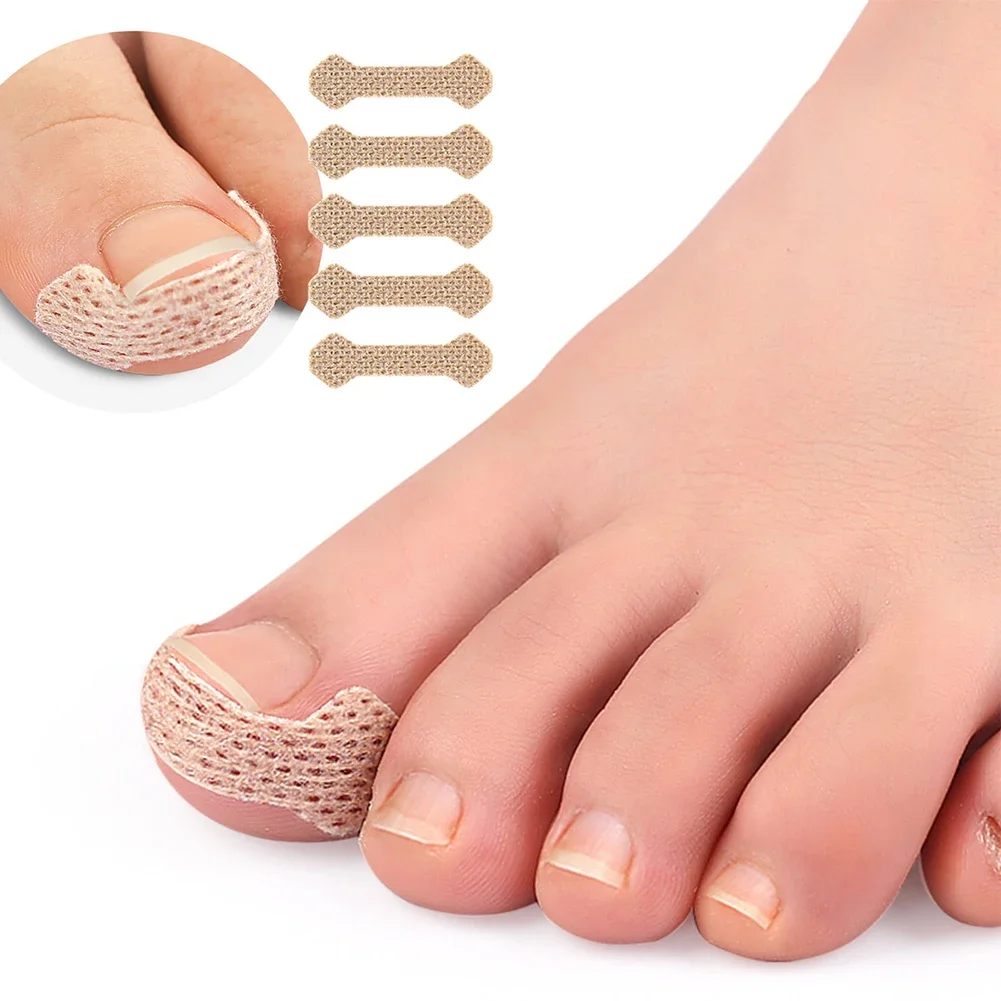 

10-100pcs Ingrown Toenail Corrector Stickers Paronychia Treatment Pedicure Toe Nail Care Corrector Patch Correction Stickers