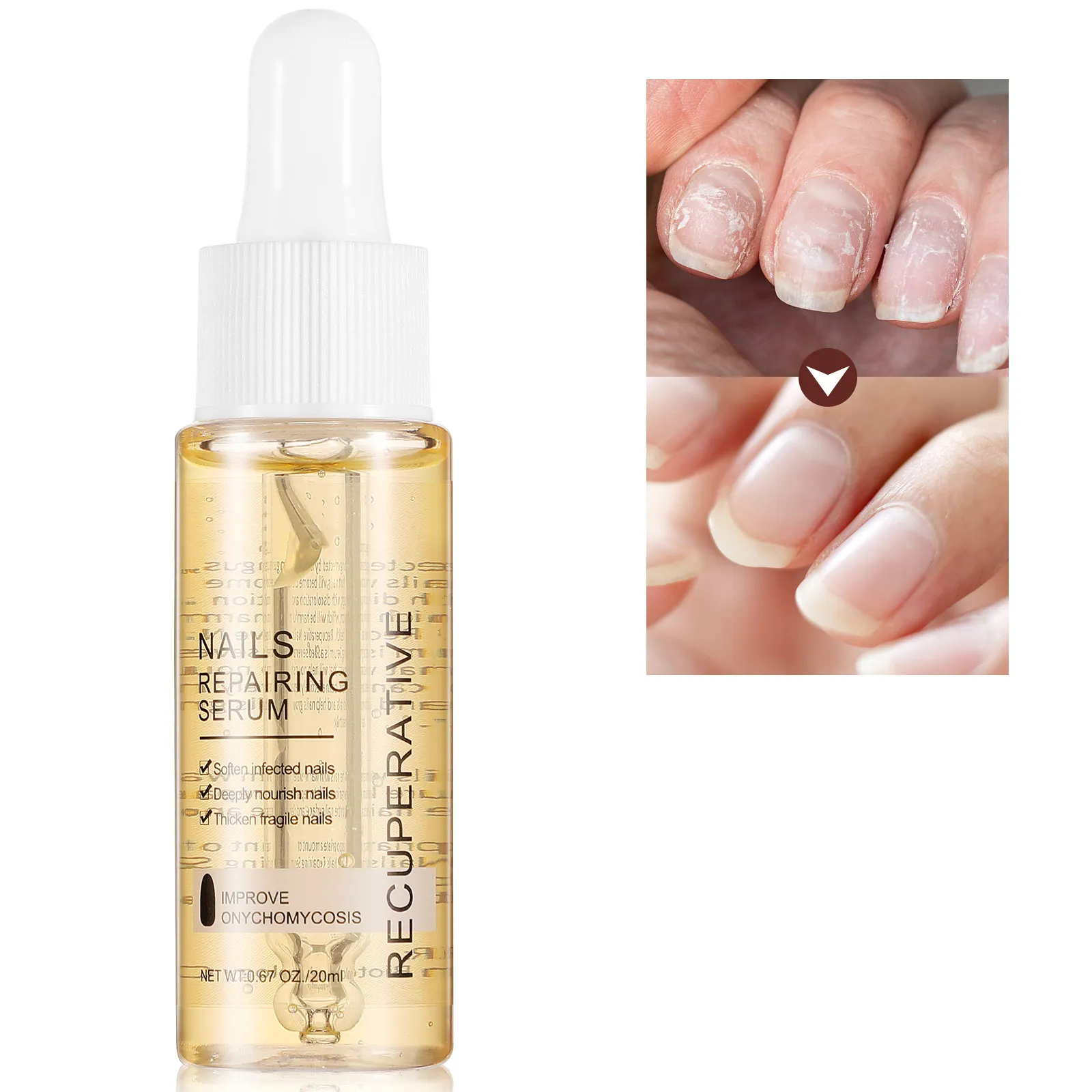 

1Pcs Gray Nail Repair Serum Treats Onychomycosis Softens Cuticles Strengthens Nails Promotes Growth Nourishing Nail Treatment