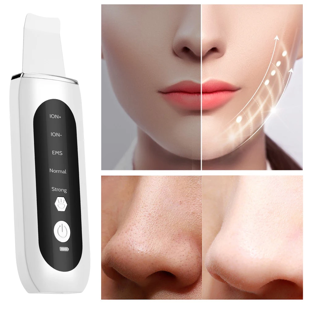 Ultrasone huidscrub voor het exfoliëren van het gezicht met ultrasone golven Ems Facial Lifting Comedondrukker Acne Pore Cleaning