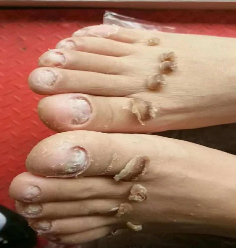 Essence Anti-betection pour Réparation des Ongles Gris N64.Beauty, Épaississement des Ongles