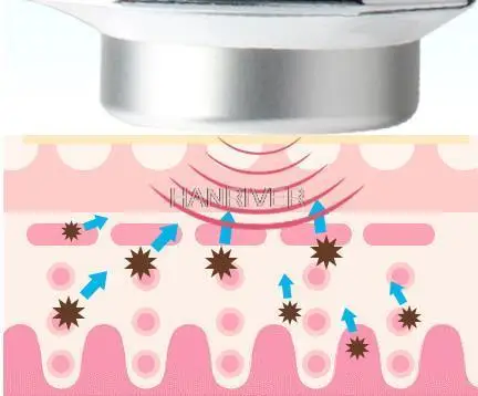 1 MHz ultrasonic body nursing facial skin beauty machine, ultrasonic regeneration wrinkles to eliminate acne pigmentation