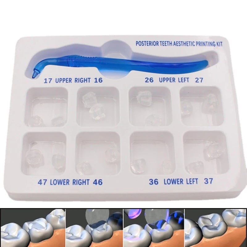 Dental Posterior Aesthetic Printing Mould Kit Light Cure Composite Filling Tools Oral Impression Forming Mold Dentistry Set