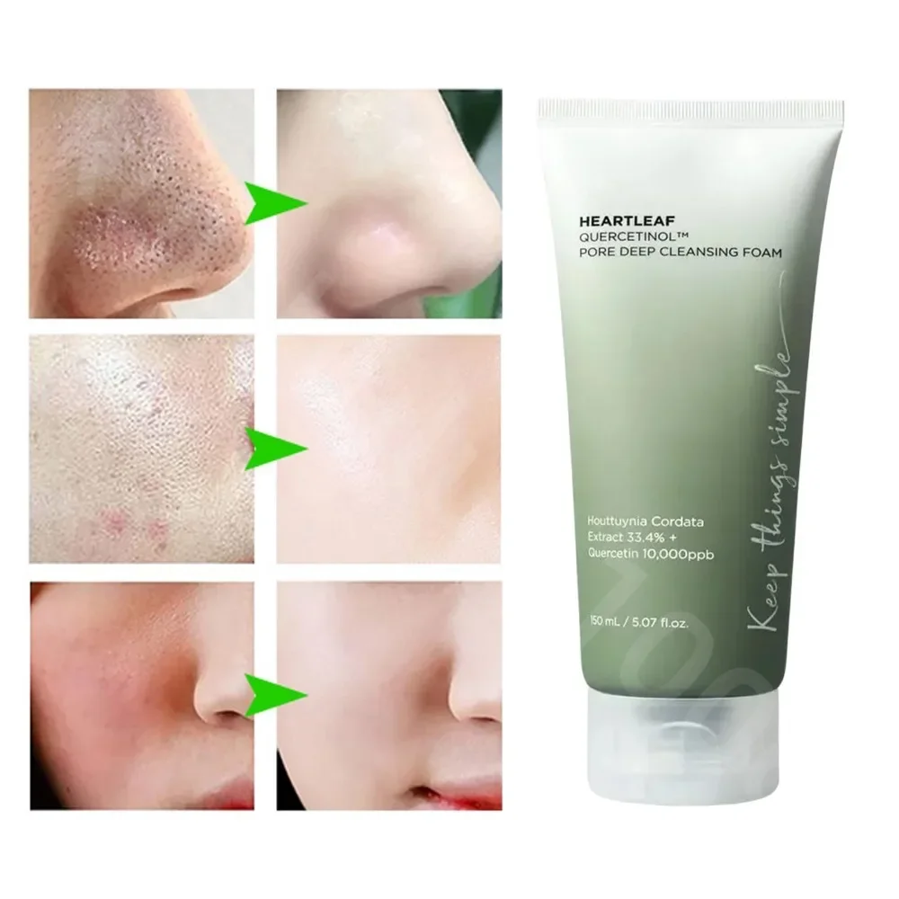 

Anua Heartleaf 77% Skin Care Moisturizing Face Wash Foam for Blackhead Oil Control Pore Deep Cleansing Facial Cleanser 150ml