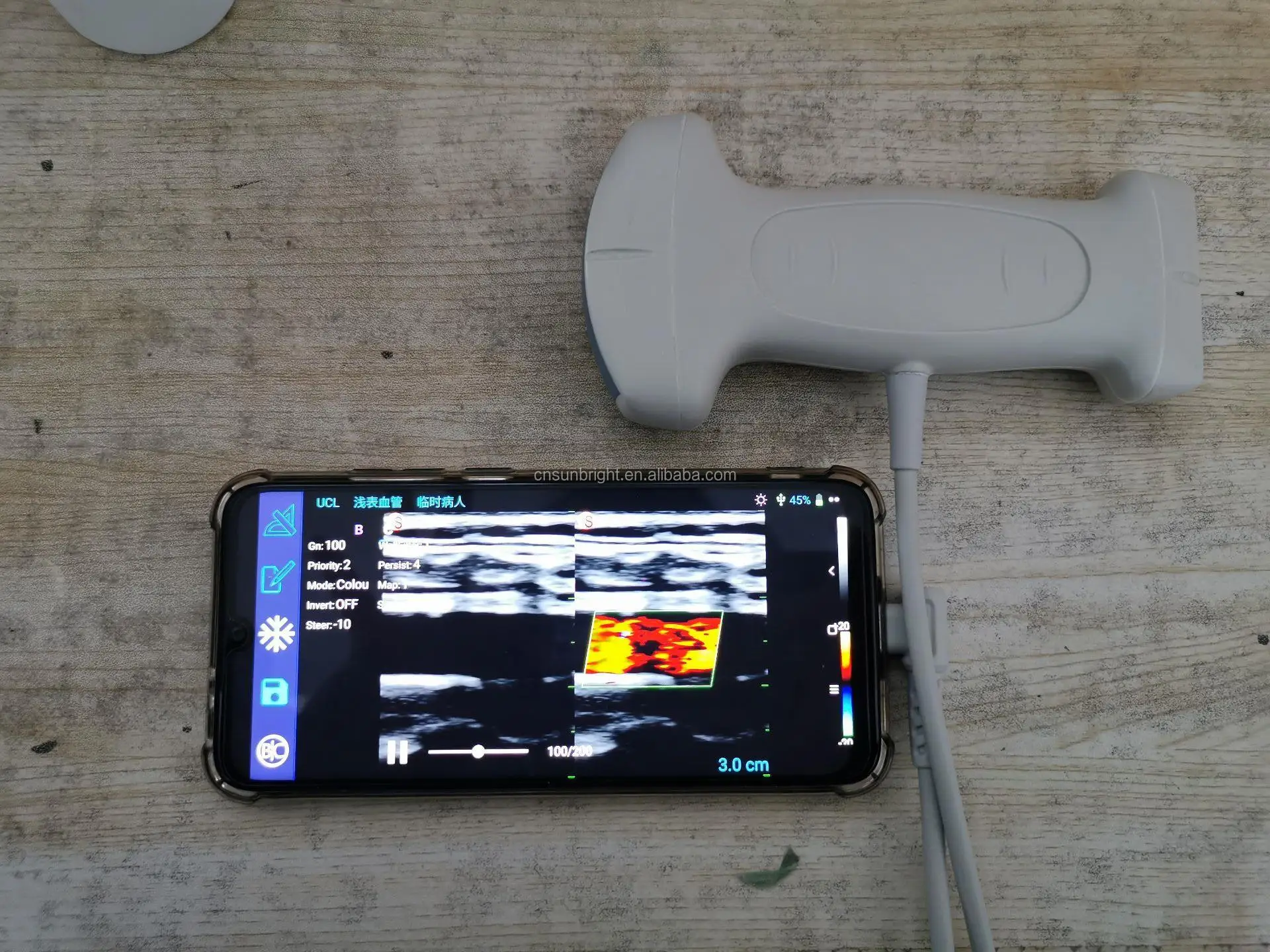 SUN-D3 portable USB dual linear and convex probe ecografo portatil color doppler ultrasound