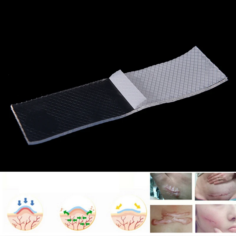 ~ ~ Hot Sale Scar Therapy Remove Trauma Burn Silicon Patch Reusable  Gel Skin Repair New
