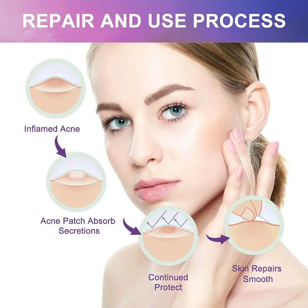 120 قطعة شكل قلب ملون حب الشباب بقع الغروانية المائية لطيف ورقيقة جدا بثرة التصحيح حب الشباب بقعة امتصاص العناية بالبشرة غير مرئية #6