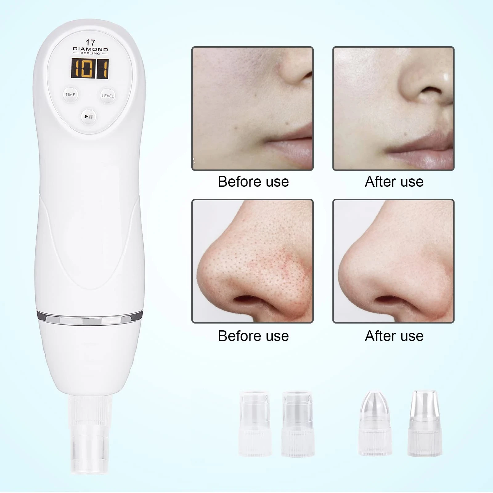 Diamond Dermabrasion Skin Peeling Beauty Machine Vacuum Blackhead Acne Remove Face Cleaning Facial Pore Cleaner Equipment lesen