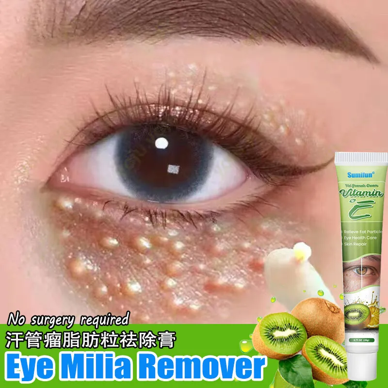 Fat Granules Remover Eye Cream Effective Remove Fat Granules Puffiness Anti-Particles Milia Remover Product Repair Eye Skin Care