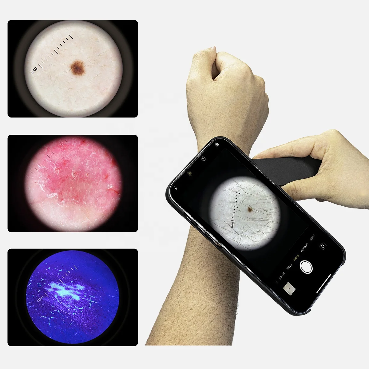 IBOOLO DE-4100 PRO الشركة المصنعة OEM وODM أدوات منظار الجلد الطبي السريري لفحص فروة الرأس والشعر