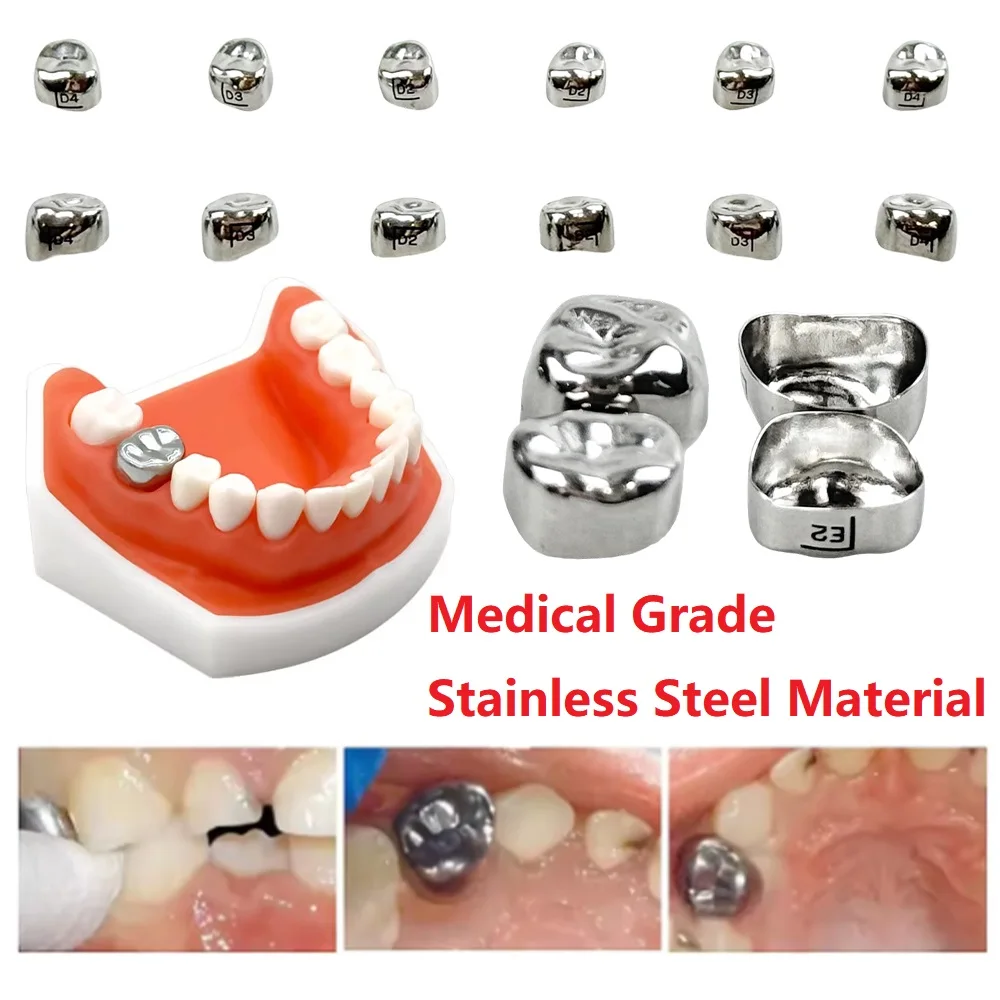 

12 шт./кор., стоматологические временные коронки, детские первичные молярные зубы, 1-я 2-я корона, инструменты из нержавеющей стали для стоматологии, ортодонтического материала