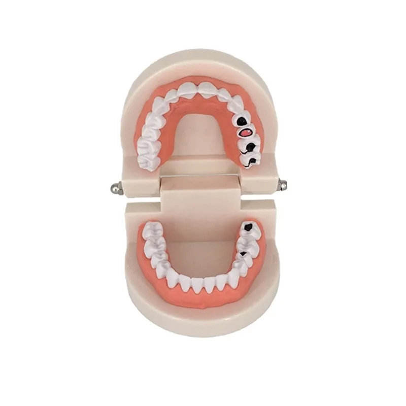 Dental Teaching Modell Standard Dental Kieferorthopädische Zähne Modell Mit Zahnspangen Metall/Keramik Klammern Für Zahnmedizin Bildung Studie