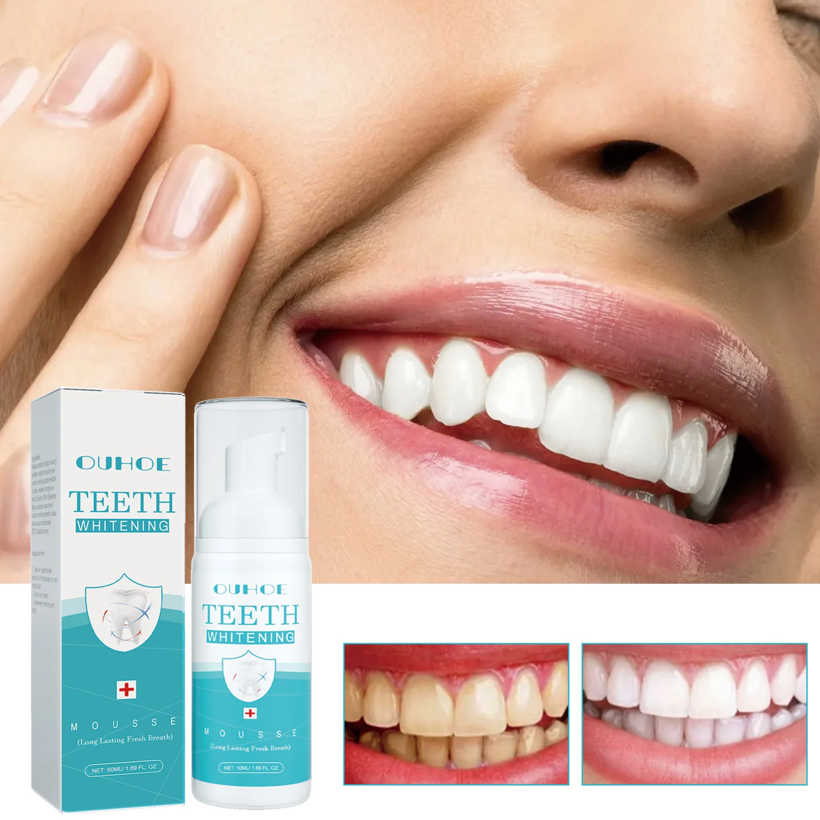 

Teeth Whitening Mousse – Cleans tartar, freshens breath, prevents cavities, cares for gums, oral cleaning