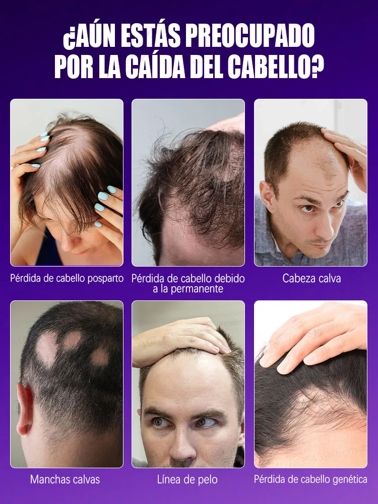 毛包を刺激し、頭皮に栄養を与え、7日間で髪を素早く再生します