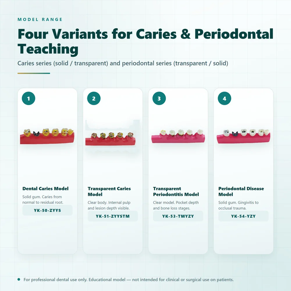 Dental Pathology Model 1:1 Caries and Periodontitis Demonstration Model for Dentist Student Oral Teaching Patient Communication