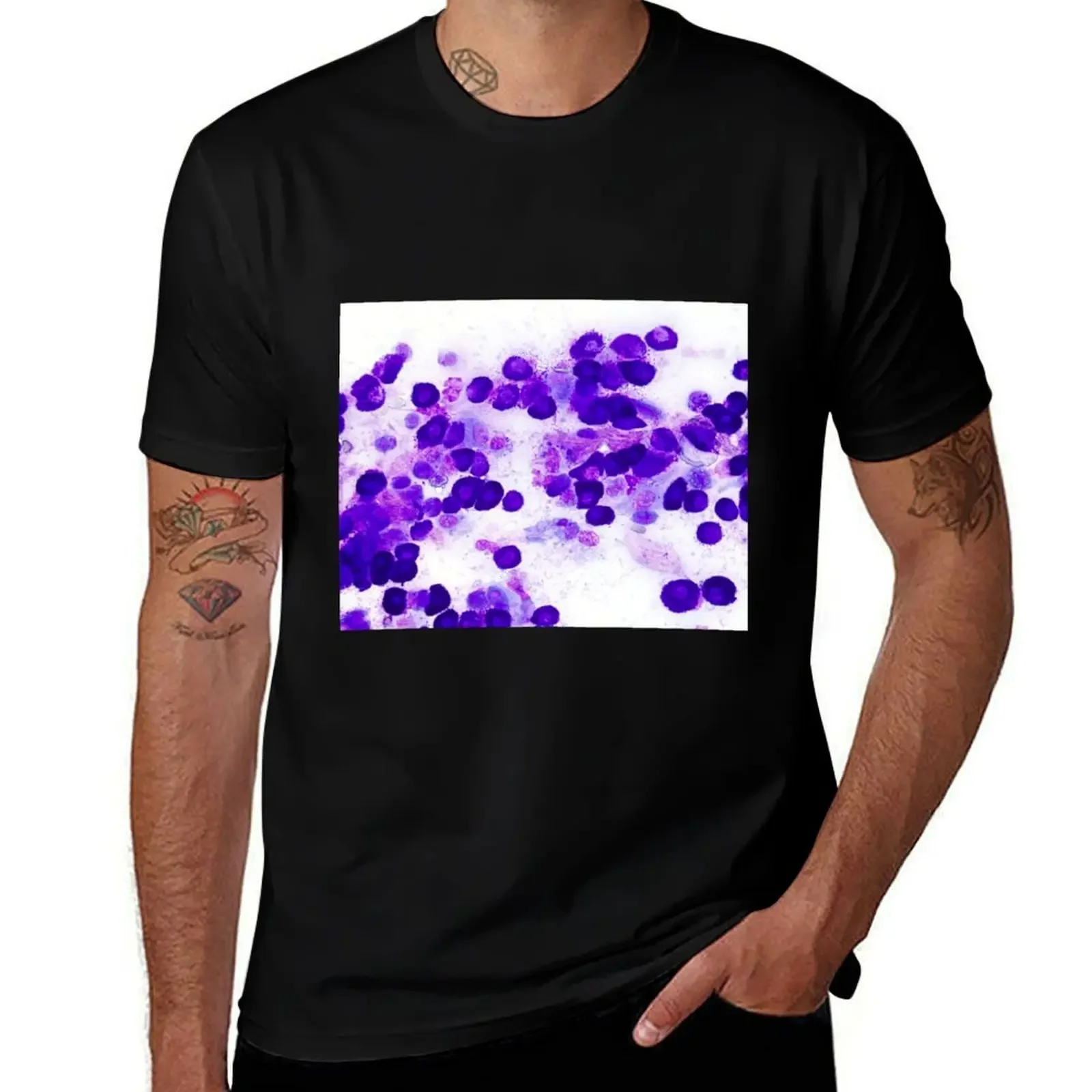 

Mast cell tumor (MCT) T-Shirt oversized football t shirt cotton graphic tees korean fashion t shirts men