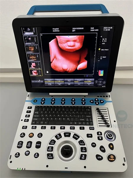 Рисунок 2 - C57 Высококачественная ультразвуковая