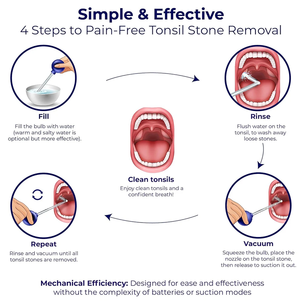 مجموعة أدوات تنظيف حجر اللوز |   15 ° +90 °   أنبوب زجاجي منحني + كرة شفط يدوية |   منظف الألحان يزيل الحجارة العنيدة بسهولة #6