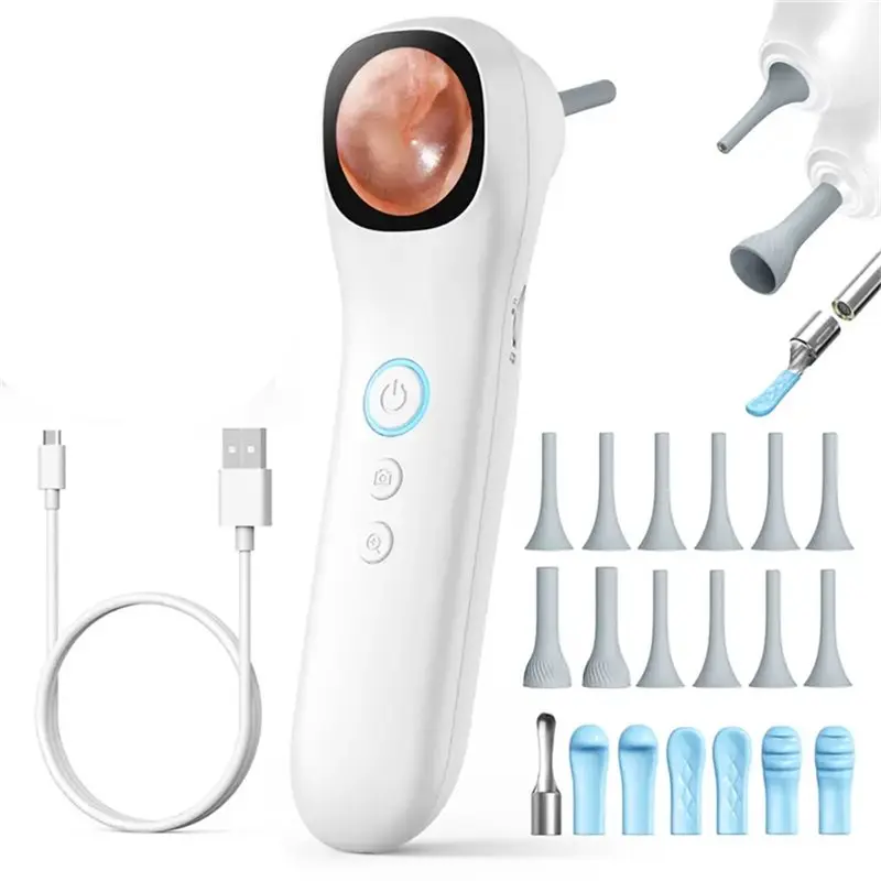 ABAG 1080P HD Otoscopio visivo digitale per orecchio 1.21 pollici Smart Visual Ear Wax Strumento pulito Supporto per scattare foto e video per l'orecchio del naso