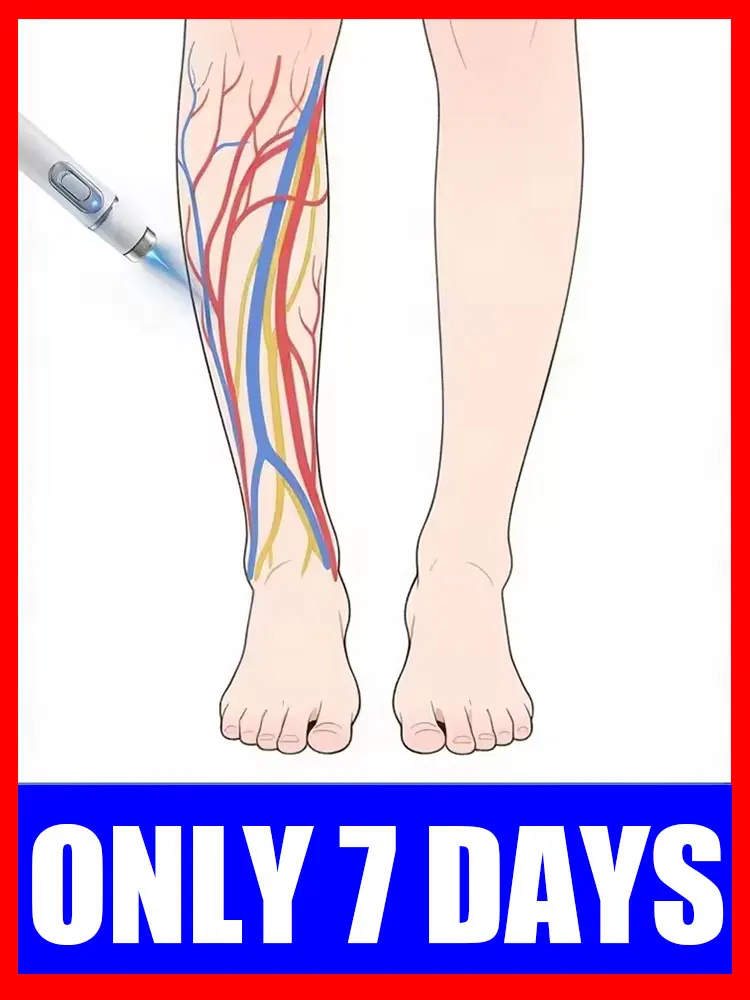 strumenti-per-la-cura-delle-gambe-per-alleviare-il-disagio-delle-gambe-e-la-pressione-delle-gambe-vene-varicose