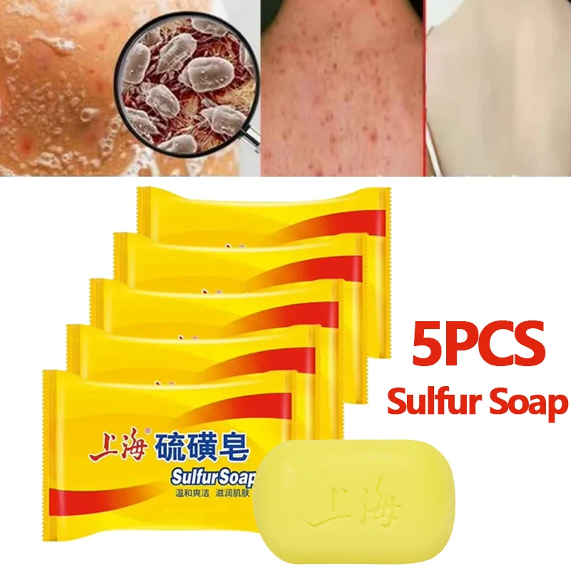 

5 шт./3 шт. Шанхайское серное мыло, мыло для ванны, глубокая очистка рук и лица, сохраняет очищение за кожей лица, глубокая очистка, унисекс