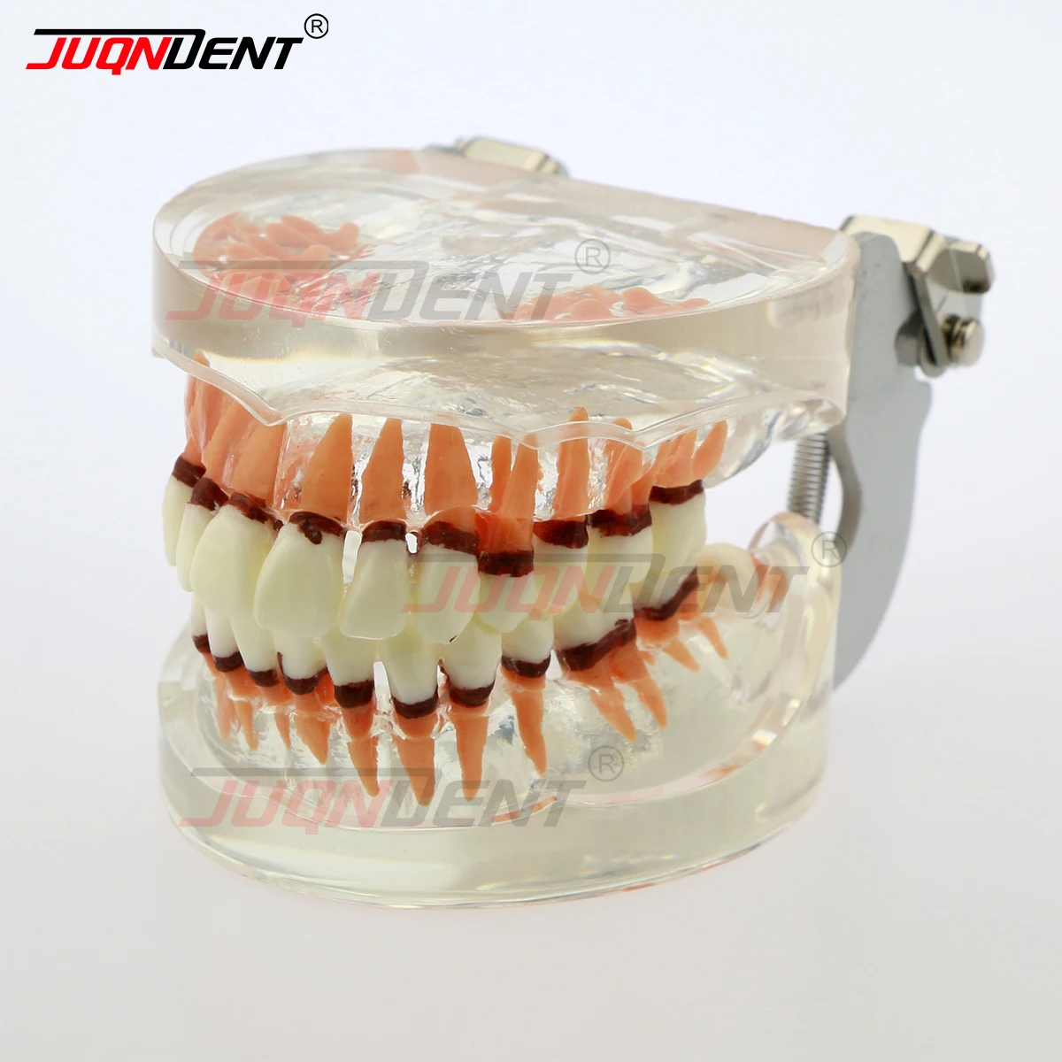 JUQNDENT Dental Teaching Models Dental Adult Periodontal Disease Pathological Teeth Typodont M4017 Model Removable