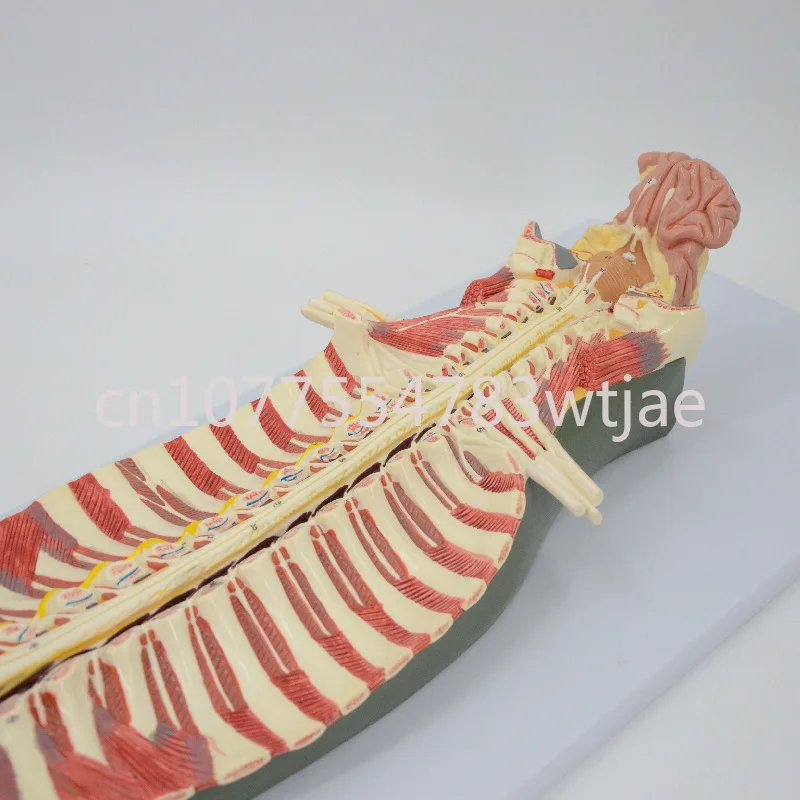 Spinal cord and spinal nerve amplification model within the spinal canal, medical teaching model