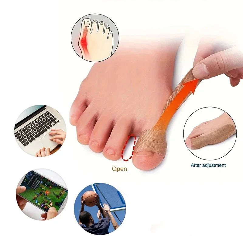 10/20Pcs Hallux Valgus Patches Big Toe Finger Thumb Orthotics Corrector Pain Relief Stickers Hand Foot Correction Protector