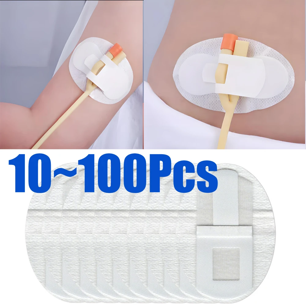 

1-100 шт. устройство для стабилизации катетера, держатель трубки катетера, клейкий катетер, сумка для мочевой ноги, держатель ленты для ног