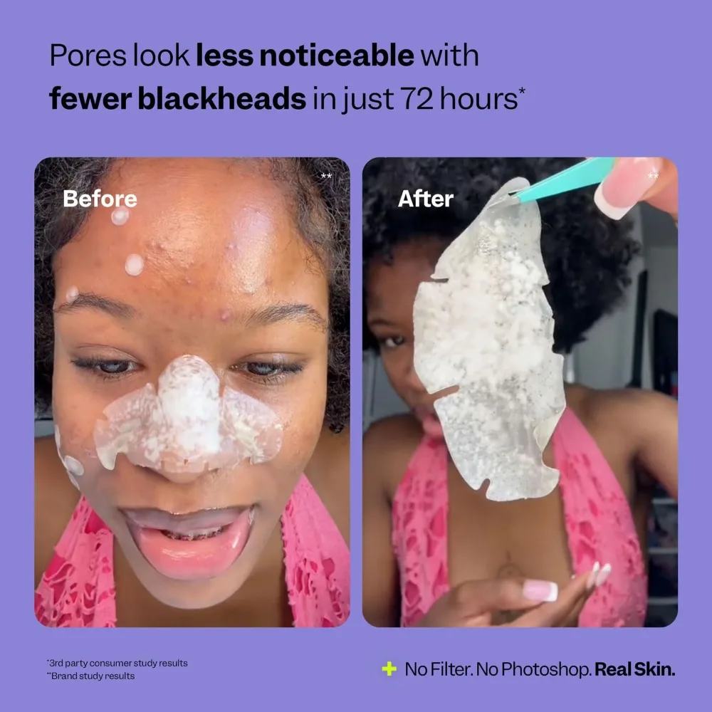 Overnight Blackhead Remover Pore Strips for Face 7 Count Hydrocolloid Nose Patches to Absorb Sebum and Gunk Thin Flexible Painless Pimple Patches Vegan Cruelty Free Korean Skin Care Beauty Treatment for Clear Pores and view 6