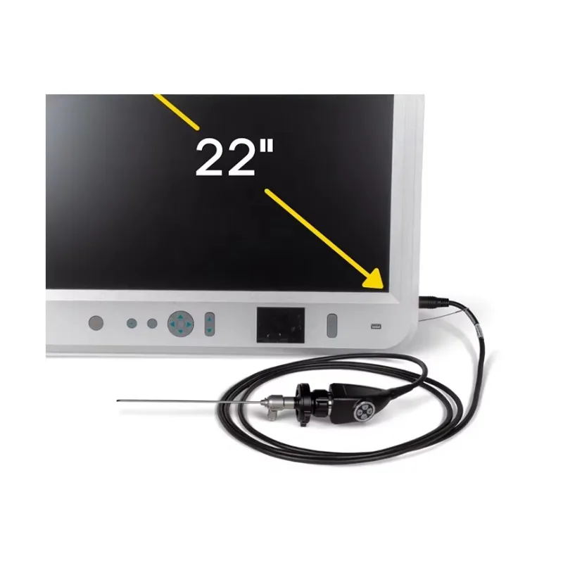 Handheld veterinary endoscopy system with 22-inch screen for rigid endoscopic diagnostics, capable of recording medical videos i