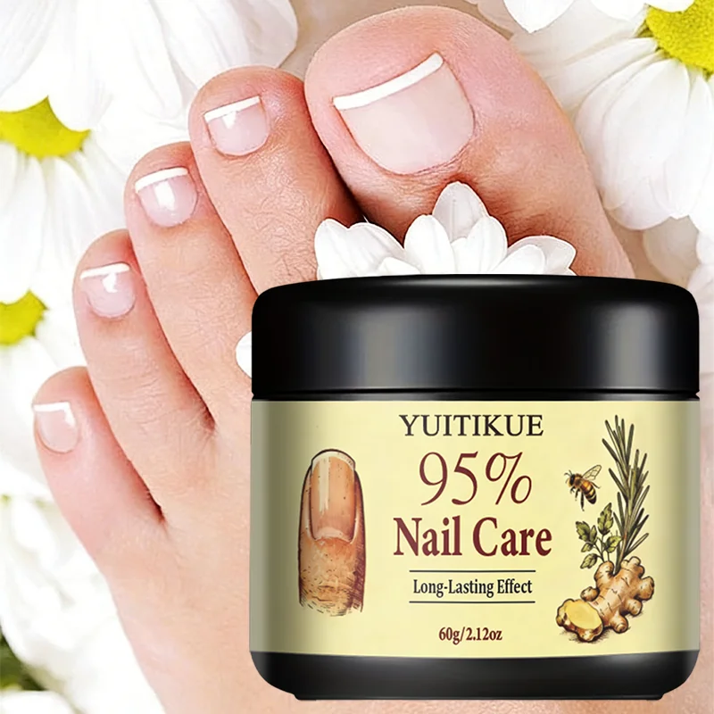 YUITIKUE 95% Nail Care Cream | Long-Lasting Nourishment | Natural Ginger & Rosemary Formula For Healthy Strong Nails 60g