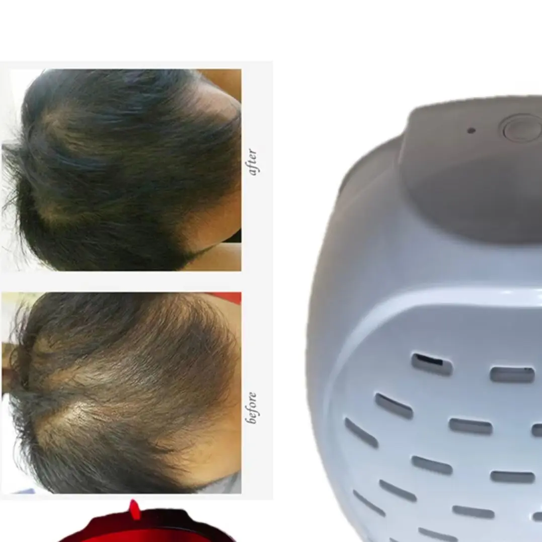 

Медицинский лазерный шлем для восстановления волос - LLLT шапочка для утолщения волос и эффективное лечение выпадения волос