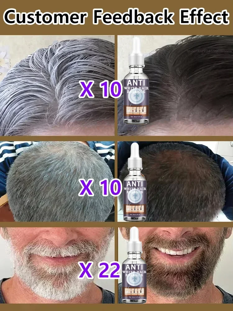 يزيل جوهر المضاد للتبييض الطبيعي النقي يزيل الشعر الرمادي ويحول الشعر الأسود من الجذور #5