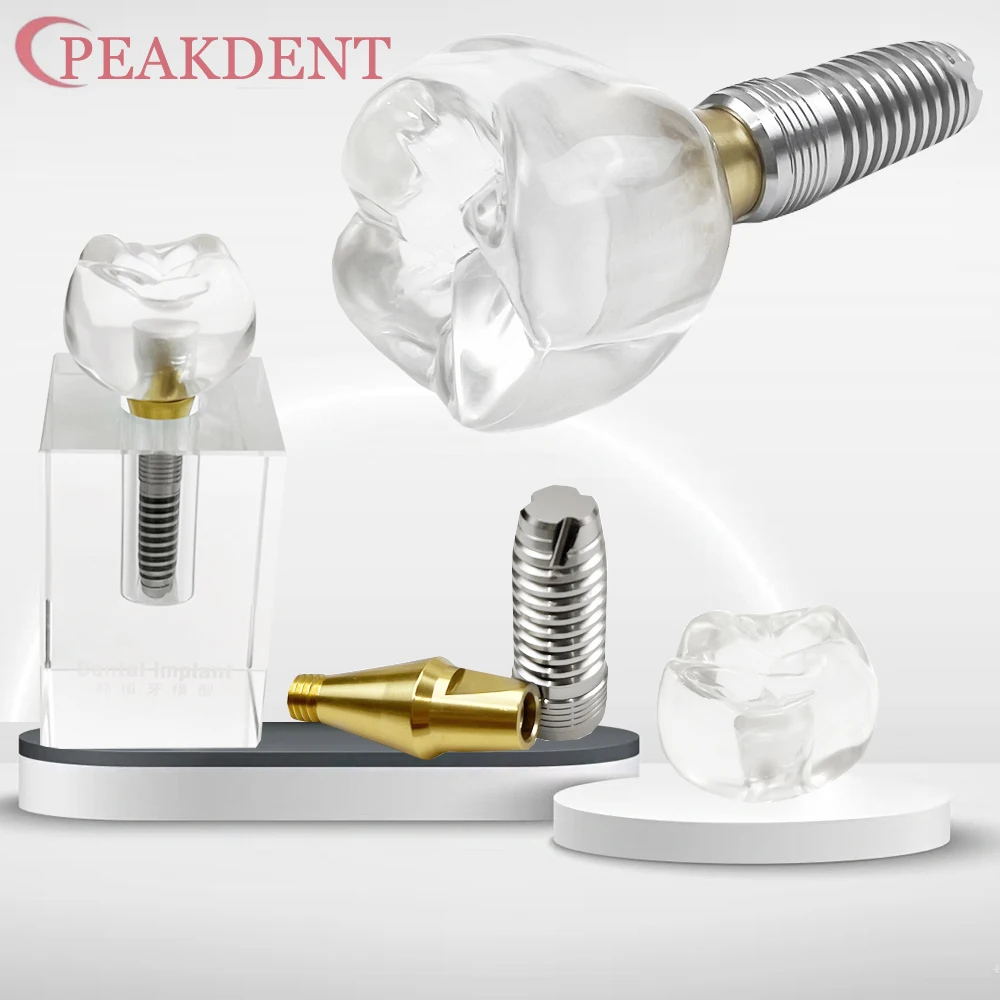 

Модель зубного кристаллического имплантата, прозрачная стоматологическая практика, съемные протезы, анализ, исследование, прозрачная стоматология