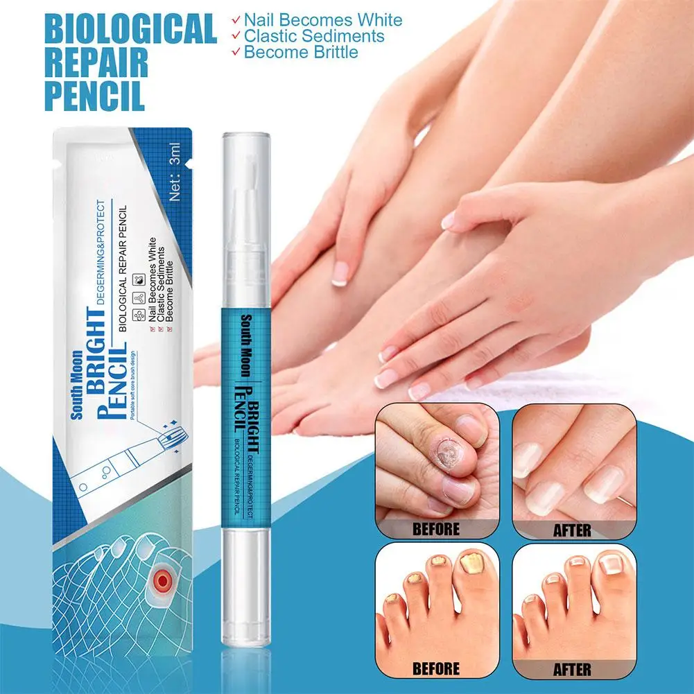 Solução de tratamento de unhas reutilizável para mulheres, essência eficaz do fungo do prego, nutrição leve, líquido reparador, Z6S3, 3ml