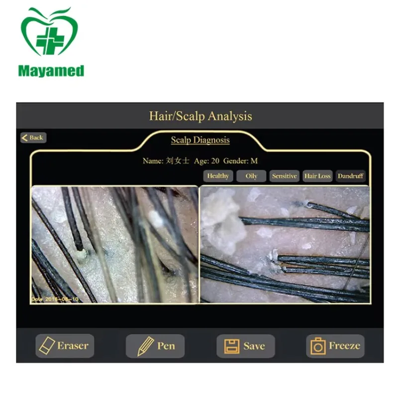 

You Will Like It MY-S122 professional boxy skin & hair analyser skin and hair testing machine