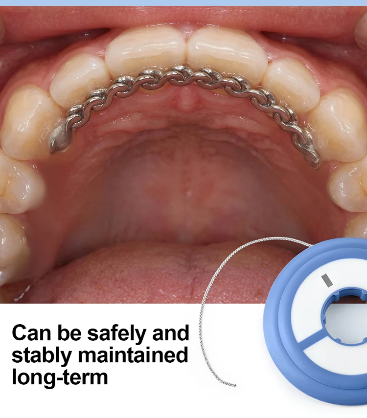 Zahnärztliche Retainer-Kette aus Edelstahl, 3,2 Fuß, zur Sicherung der Zahnposition nach der Kieferorthopädie, 3,2 Fuß, AZDENT – Detail 6