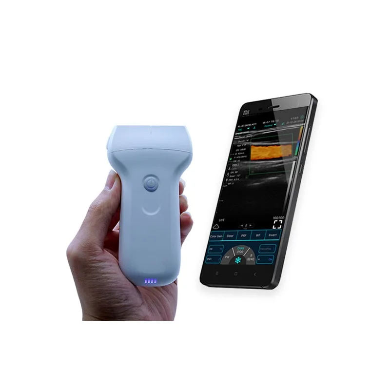 

Handheld USB+Wifi Ultrasound Double head convex+cardiac+linear probe USB&WiFi 3in1probe