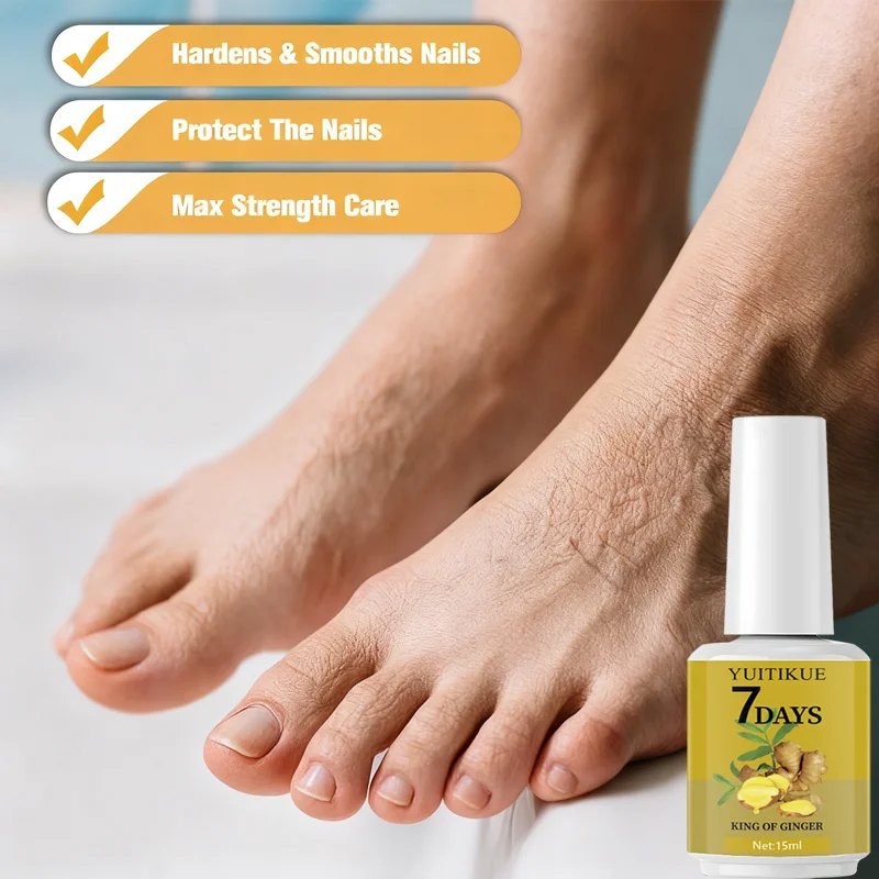 ยูอิทิคิว 7-เดย์ จินเจอร์ เนล แคร์ 15 มล. - ช่วยให้เล็บแข็งแรง เรียบเนียน และปกป้องเล็บ บำรุงหนังกำพร้าอย่างเข้มข้นเพื่อเล็บสวย