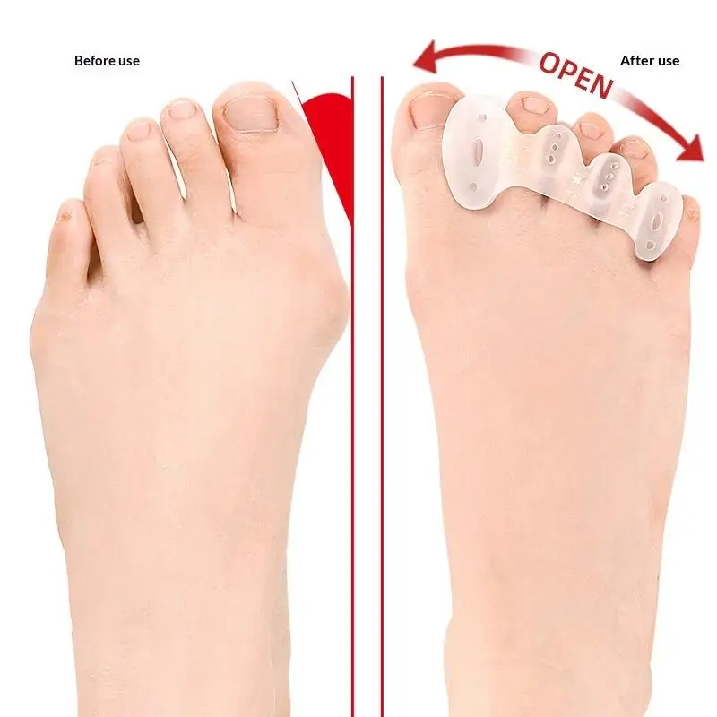 1Pair Toe Separators With Holes Correct Foot And Bunion Pain Plantar Fasciitis Toe Straightener To Improve Functional Mobility
