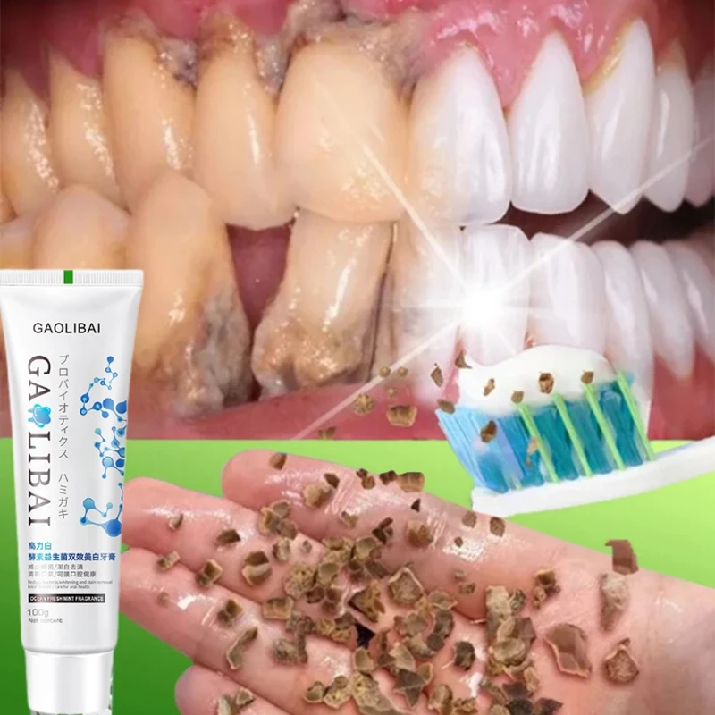 100g Tooth Restoration Toothpaste Prevents Dental Caries Toothpaste Soothes Dentine Hypersensitivity Toothpaste Fresh Breath