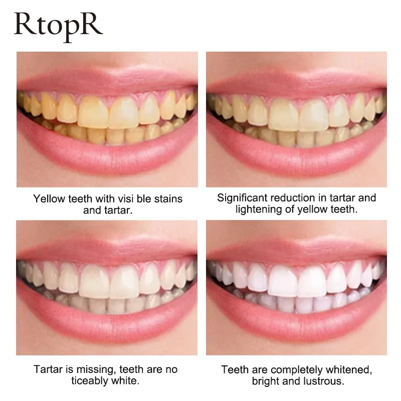 3PCS RtopR Mint Whitening Toothpaste Fresh Breath Removes Plaque Tea Stains Coffee Stains Improve Yellow Teeth Toothpaste