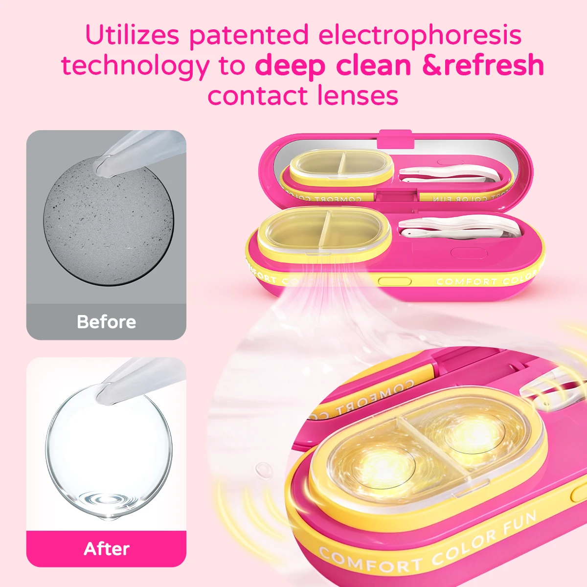 Thumbnail 2 - #72 Compare Contact Lens Cases Before You Buy