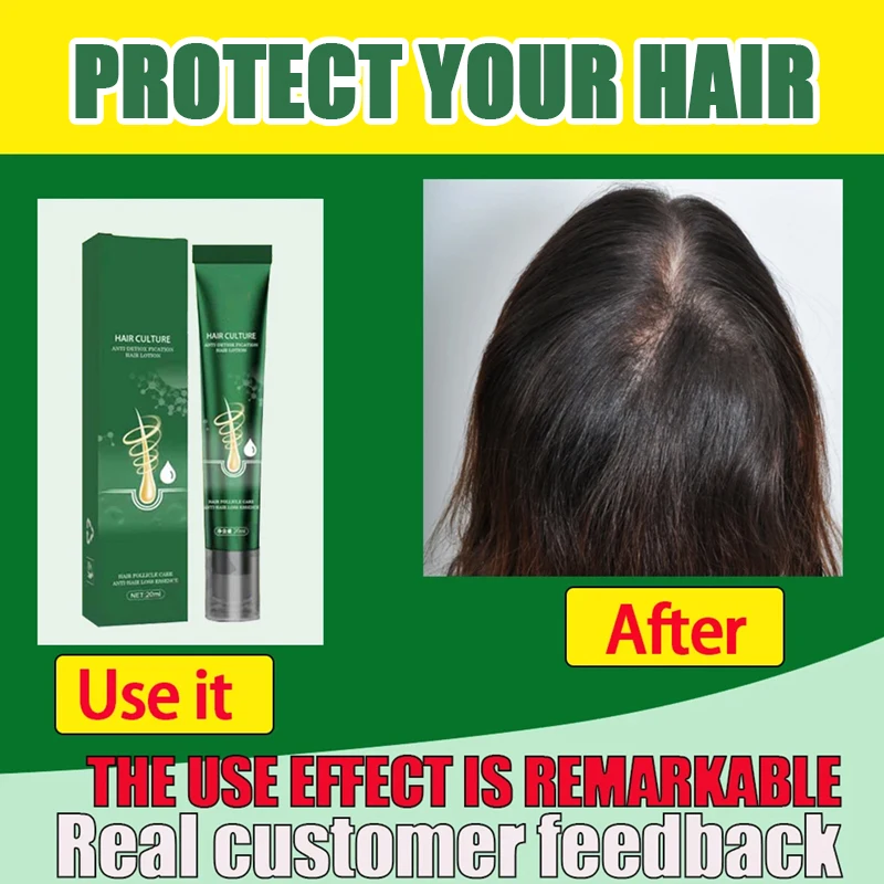 Hair Growth Oil Fast Growing Hair Effective Essential Baldness Repair Hereditary Anti Postpartum Seborrheic Hair Loss Products