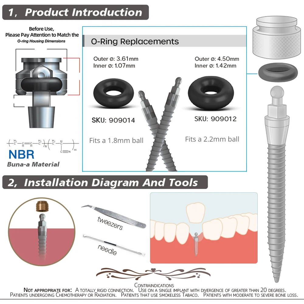 Kit de Micro junta tórica de repuesto, para Mini implante Sterngold, se adapta a una carcasa de bola de 2,2mm y 1,8mm