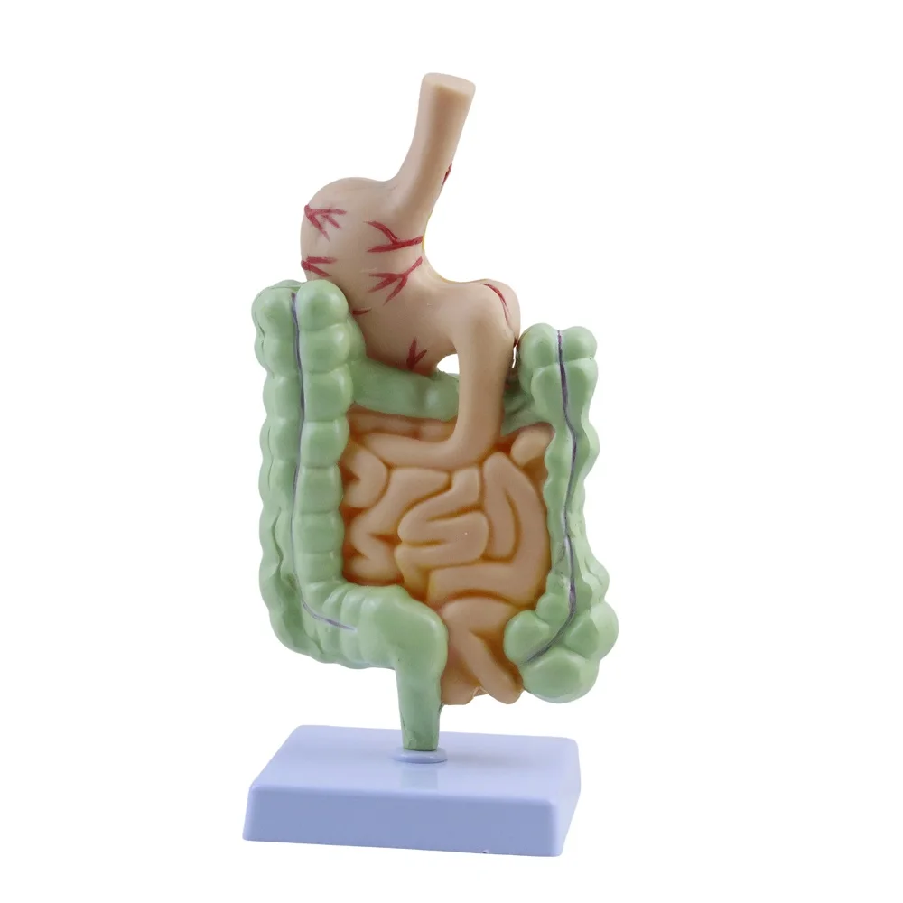 Human Large Intestine Pathological Model, Gastrointestinal Disease Anatomy Model with Stomach, Medical Teaching Tool