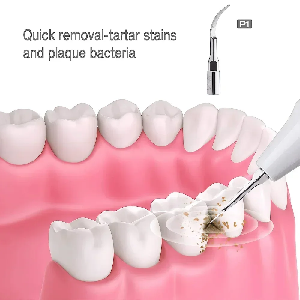 0 шт., вставки для стоматологического ультразвукового скалера, насадки для удаления накипи-подходят для ультразвукового скалера Ems и Woodpecker, включая P1/G1/GD1/PD1 Mo