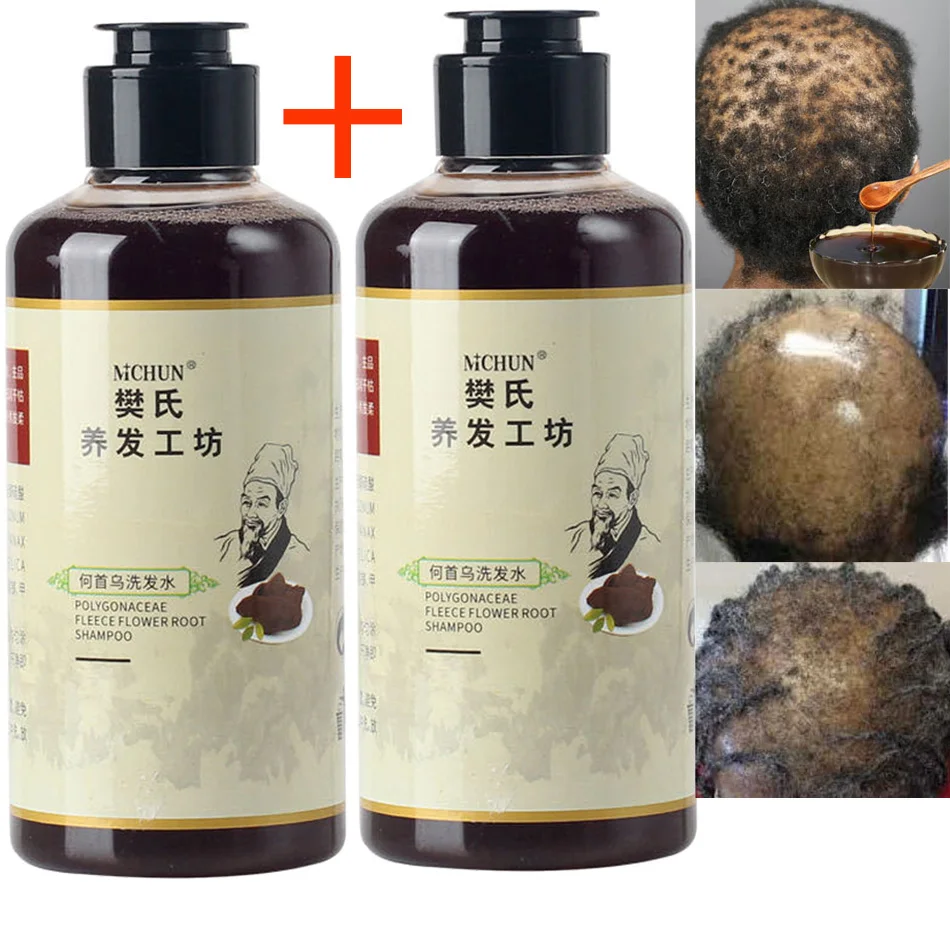 300ml Africa Women Traction Alopecia Treatment Hair Growth Product for Men Shampoo Hair Loss Treatment Get Rid of Wigs 2pcs/lot