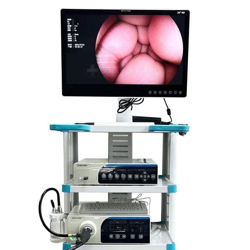 SY-PC047 Medical Surgical Laparoscopy Tower Video Endoscope  System Resectoscope Operative Hysteroscope Set